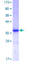 12.5% SDS-PAGE Stained with Coomassie Blue.